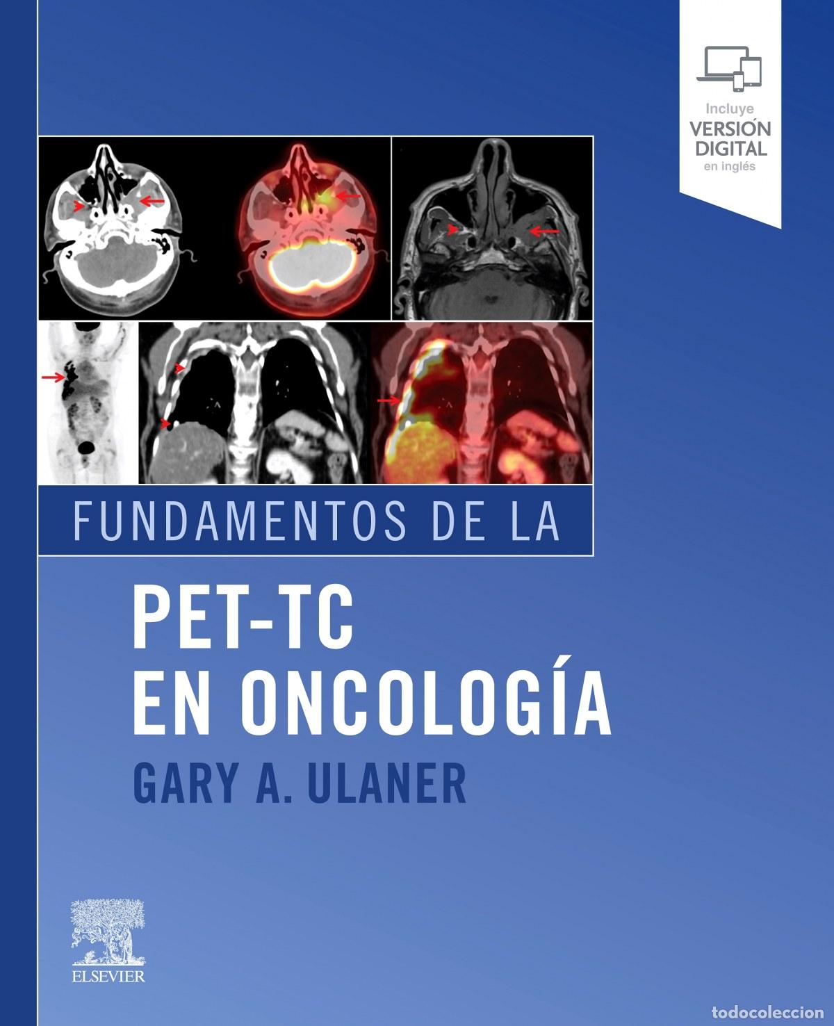 Libros: FUNDAMENTOS DE LA PET-TC EN ONCOLOG&Iacute;A - Ulaner, Gary A