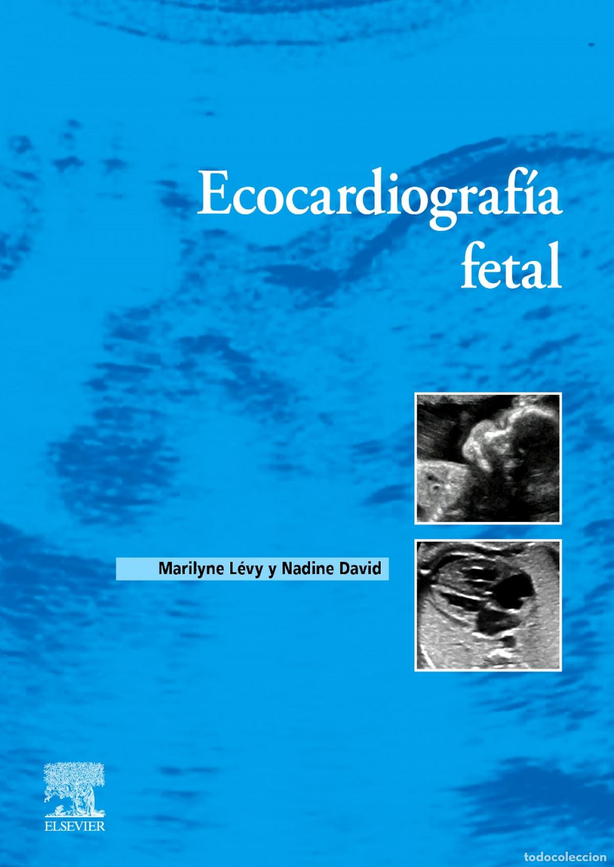 Libros: ECOCARDIOGRAFIA FETAL - LEVY