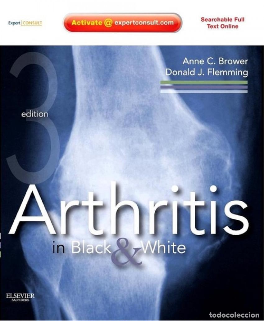 Libri: ARTHRITIS IN BLACK AND WHITE - Brower, Anne