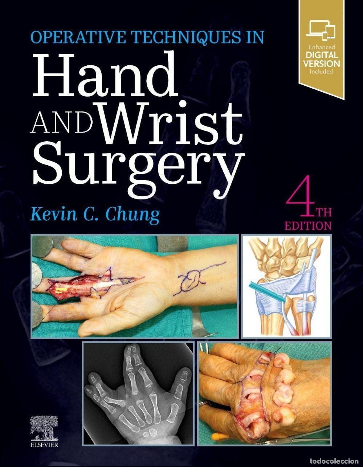 Libri: OPERATIVE TECHNIQUES: HAND AND WRIST SURGERY - Chung, Kevin