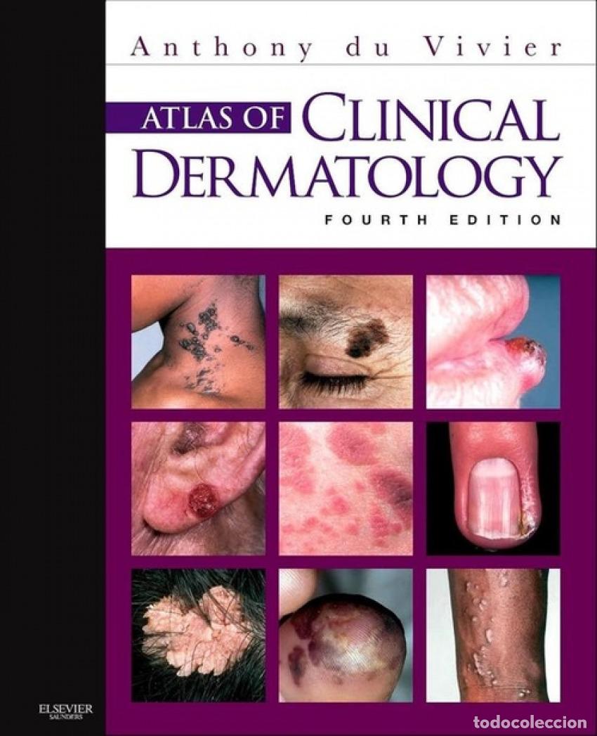 Livres: ATLAS OF CLINICAL DERMATOLOGY - du Vivier, Anthony