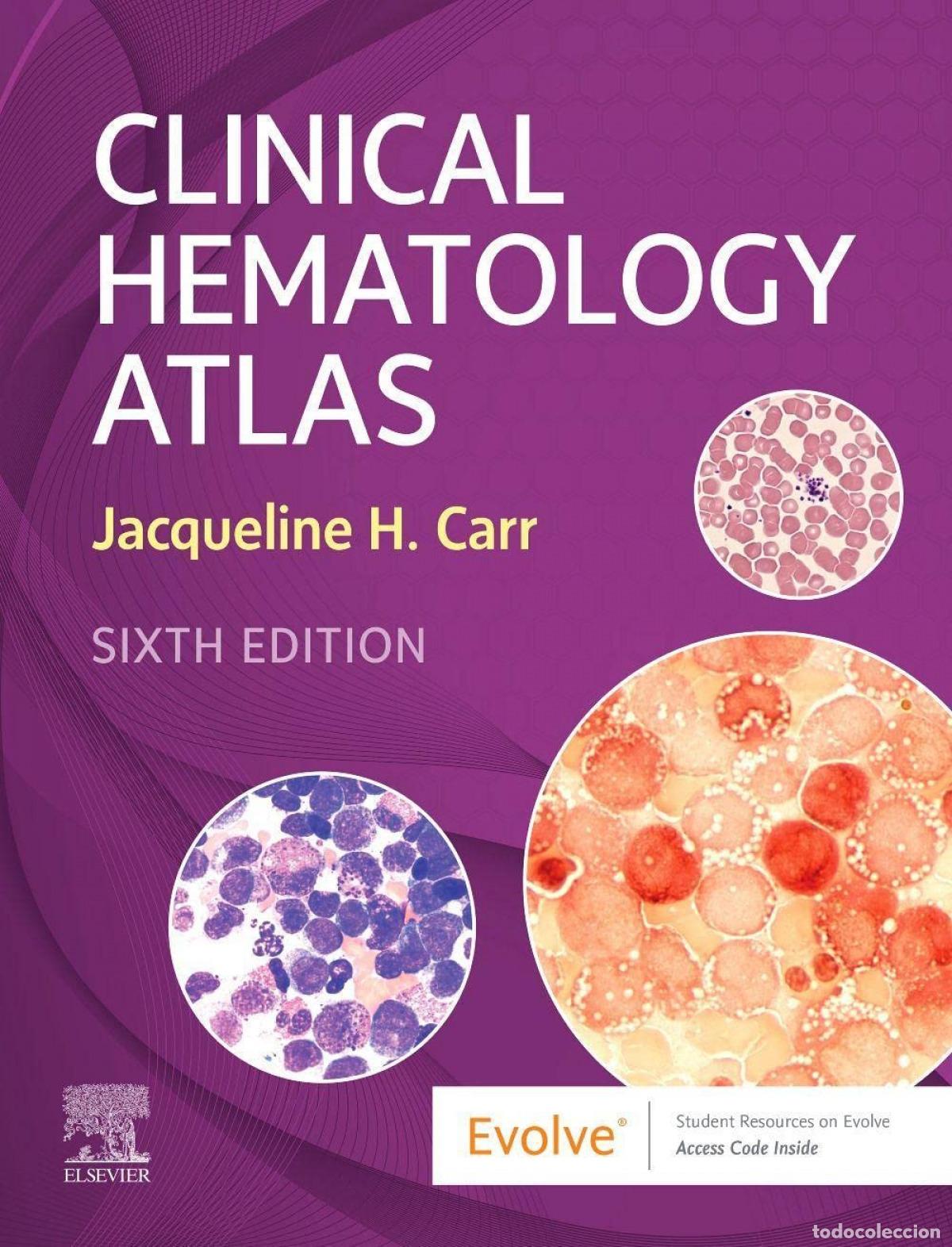 Libros: CLINICAL HEMATOLOGY ATLAS - H Carr, Jacqueline