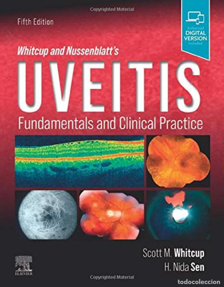 Libros: WHITCUP AND NUSSENBLATT&acute;S UVEITIS - Whitcup