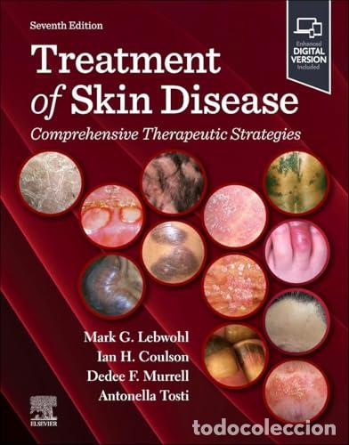 Libri: TREATMENT OF SKIN DISEASE - Lebwohl