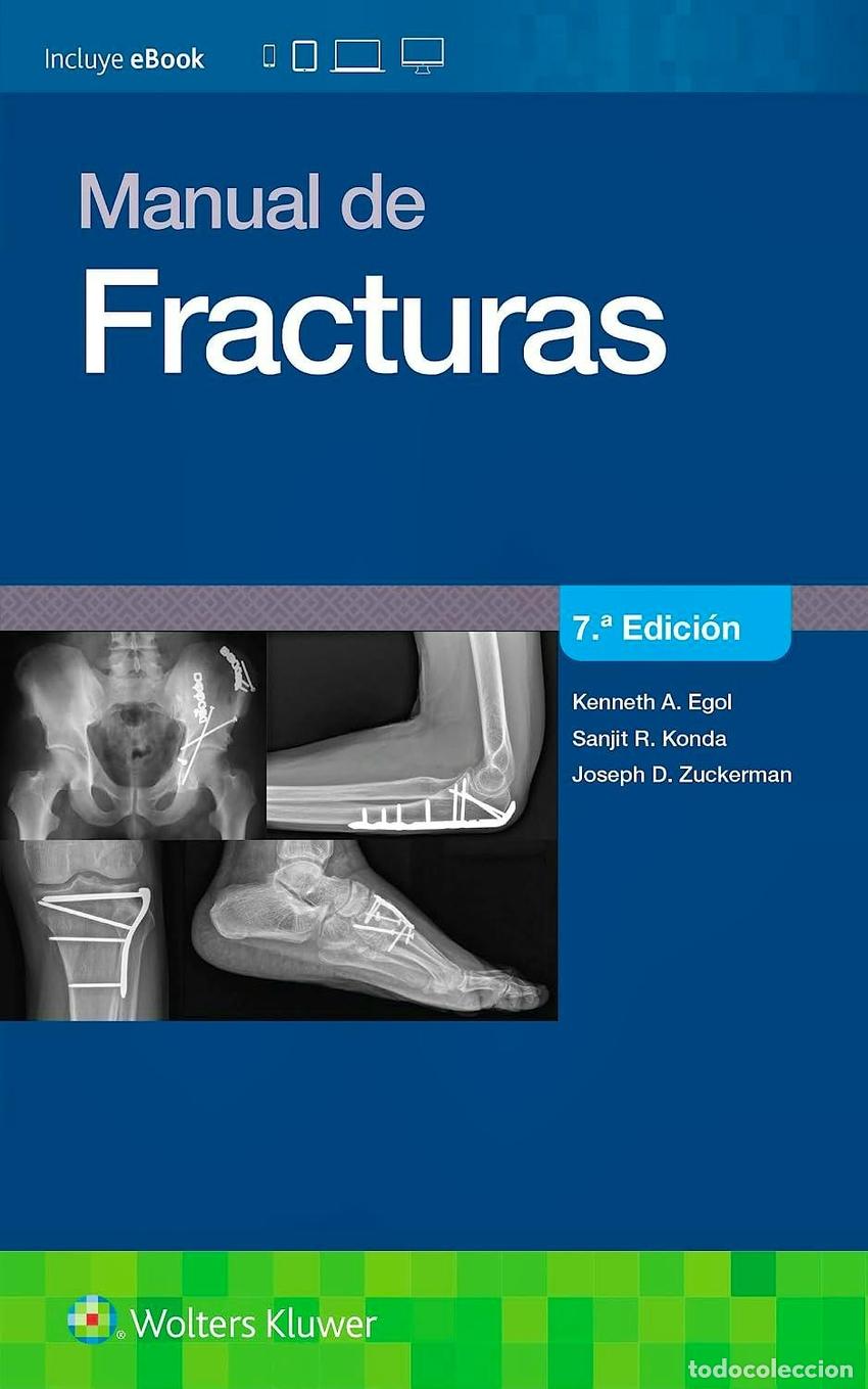 Livres: MANUAL DE FRACTURAS - Egol