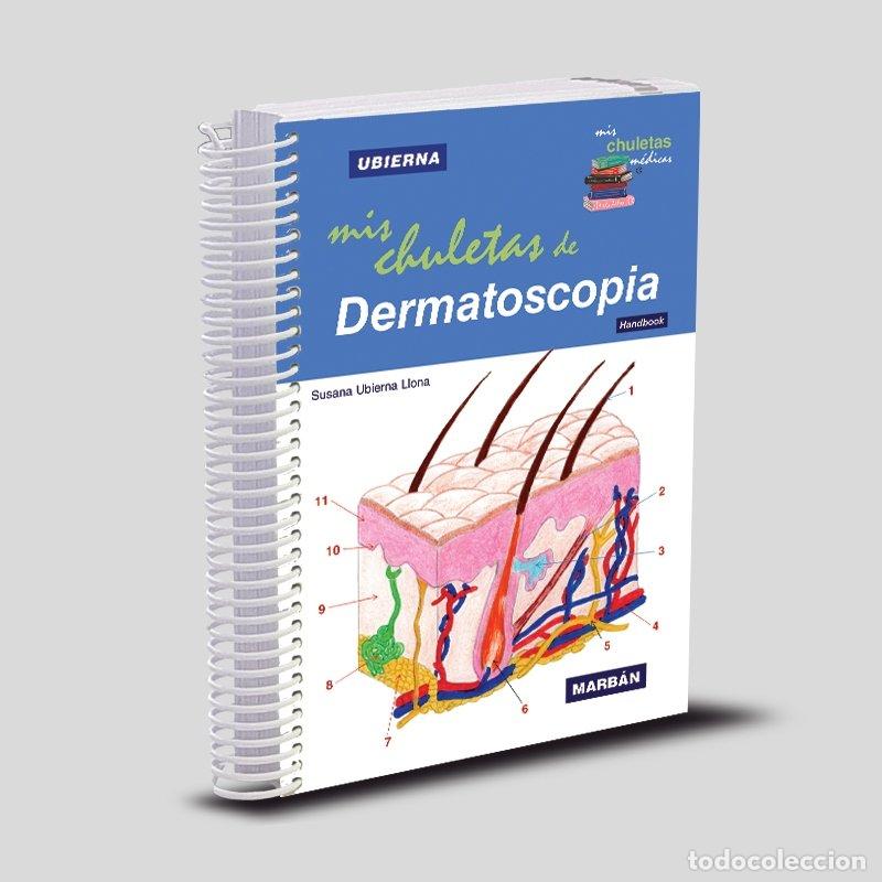Libri: MIS CHULETAS DE DERMATOSCOPIA - UBIERNA LLONA, SUSANA