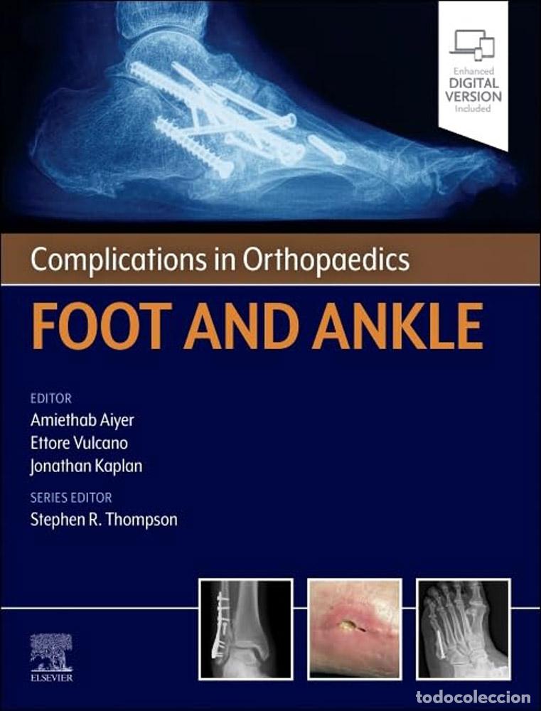 Livros: COMPLICATIONS IN ORTHOPAEDICS:FOOT AND ANKLE - Aiyer