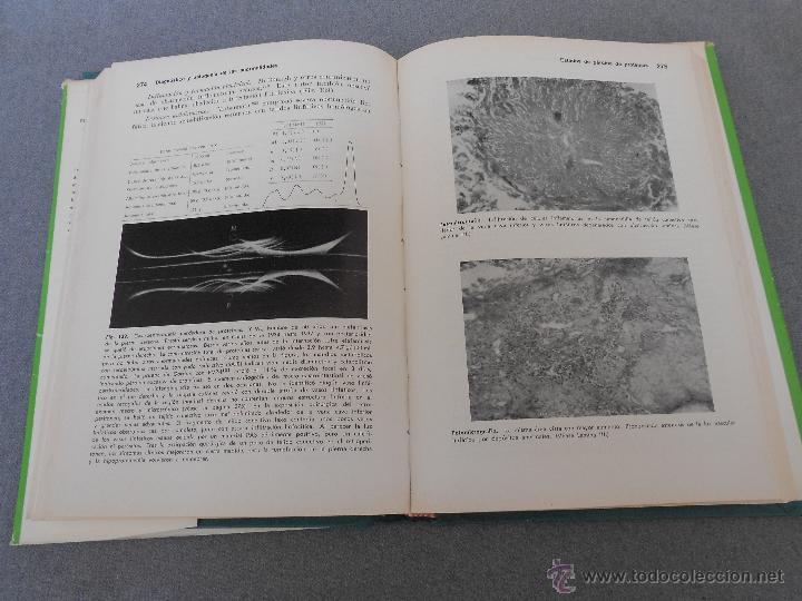 Libros de segunda mano: PROTEINAS PLASMATICAS. APLICACION CLINICA. - Foto 3