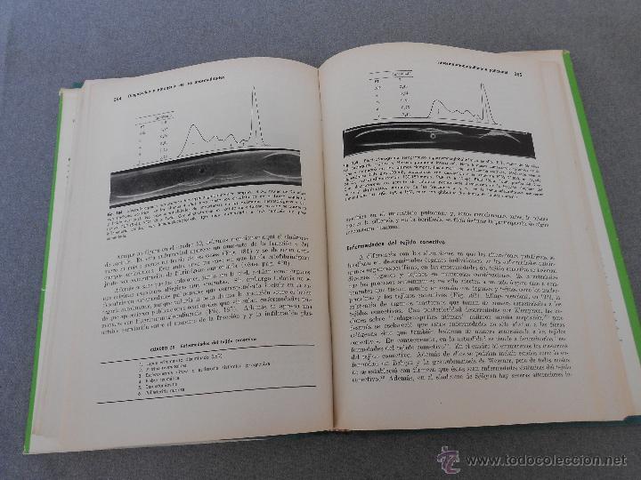 Libros de segunda mano: PROTEINAS PLASMATICAS. APLICACION CLINICA. - Foto 4