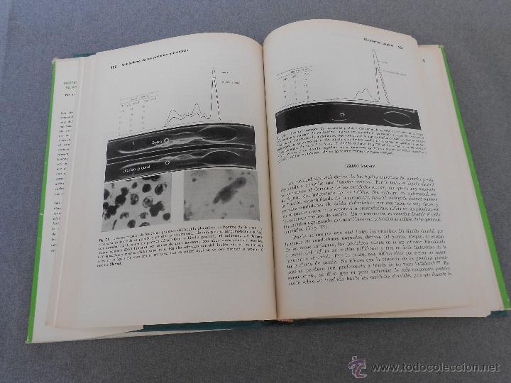 Libros de segunda mano: PROTEINAS PLASMATICAS. APLICACION CLINICA. - Foto 5