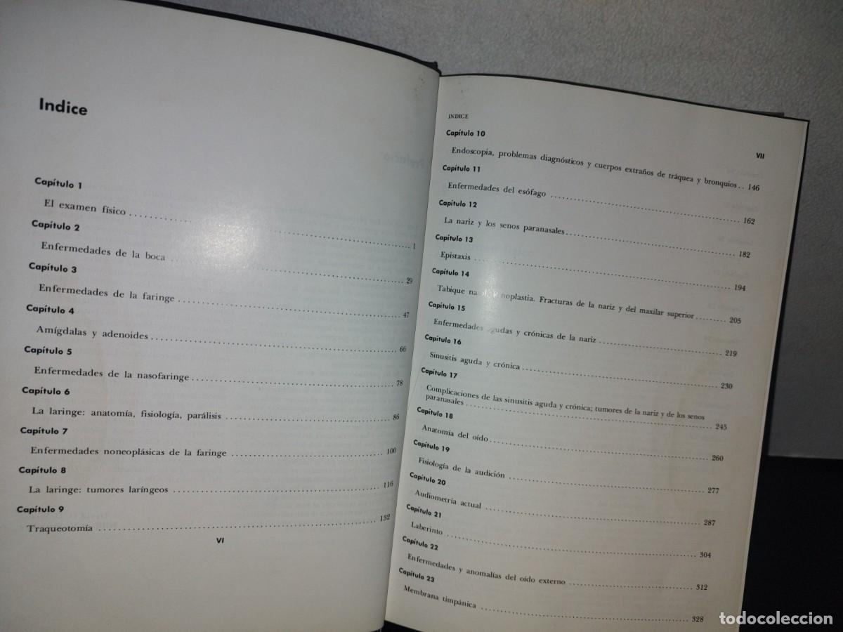 Libros de segunda mano de ciencias: 129- TRATADO DE OTORRINOLARINGOLOG&Iacute;A - DR. DAVID D. DEWEESE - Foto 6