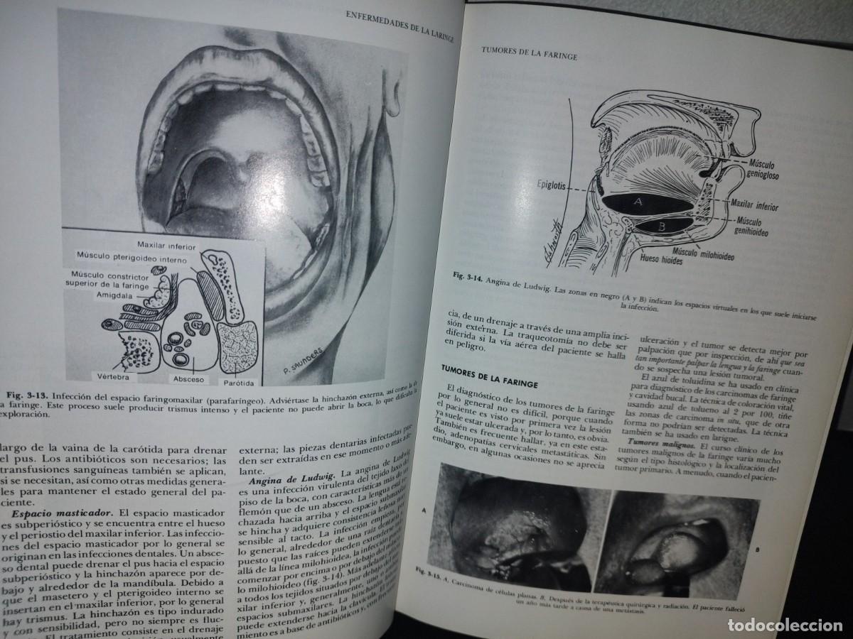Libros de segunda mano de ciencias: 129- TRATADO DE OTORRINOLARINGOLOG&Iacute;A - DR. DAVID D. DEWEESE - Foto 8
