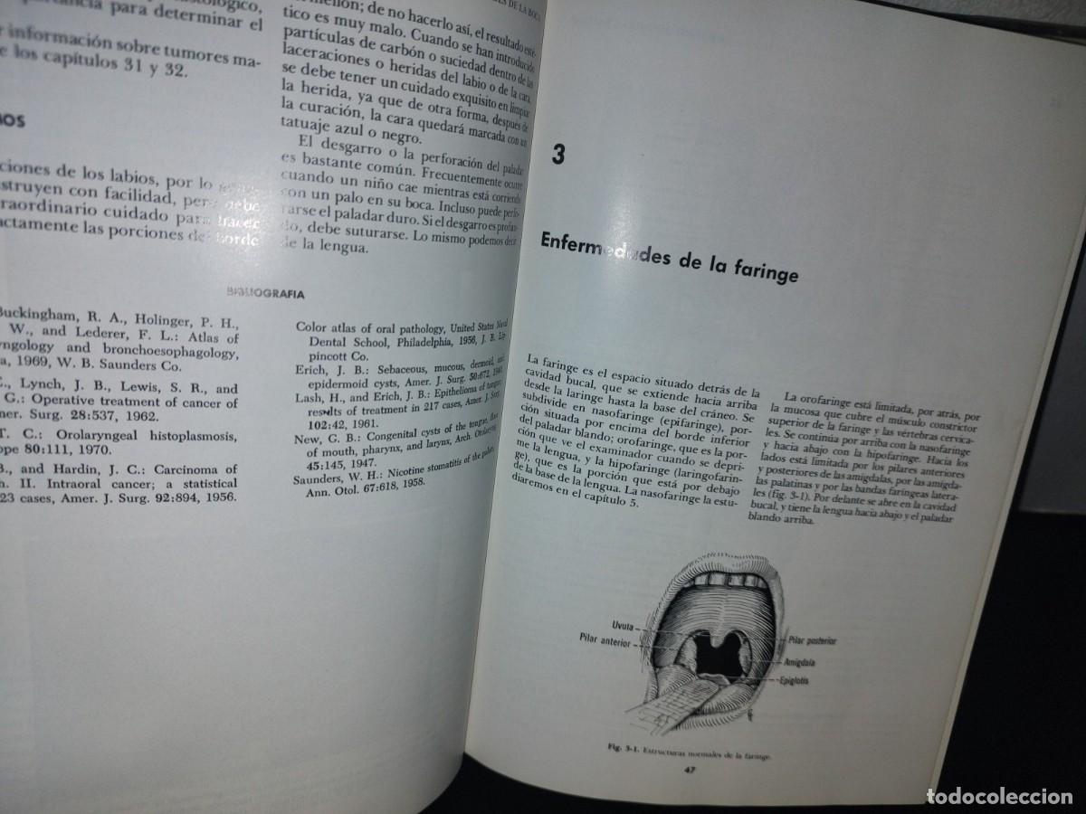 Libros de segunda mano de ciencias: 129- TRATADO DE OTORRINOLARINGOLOG&Iacute;A - DR. DAVID D. DEWEESE - Foto 9