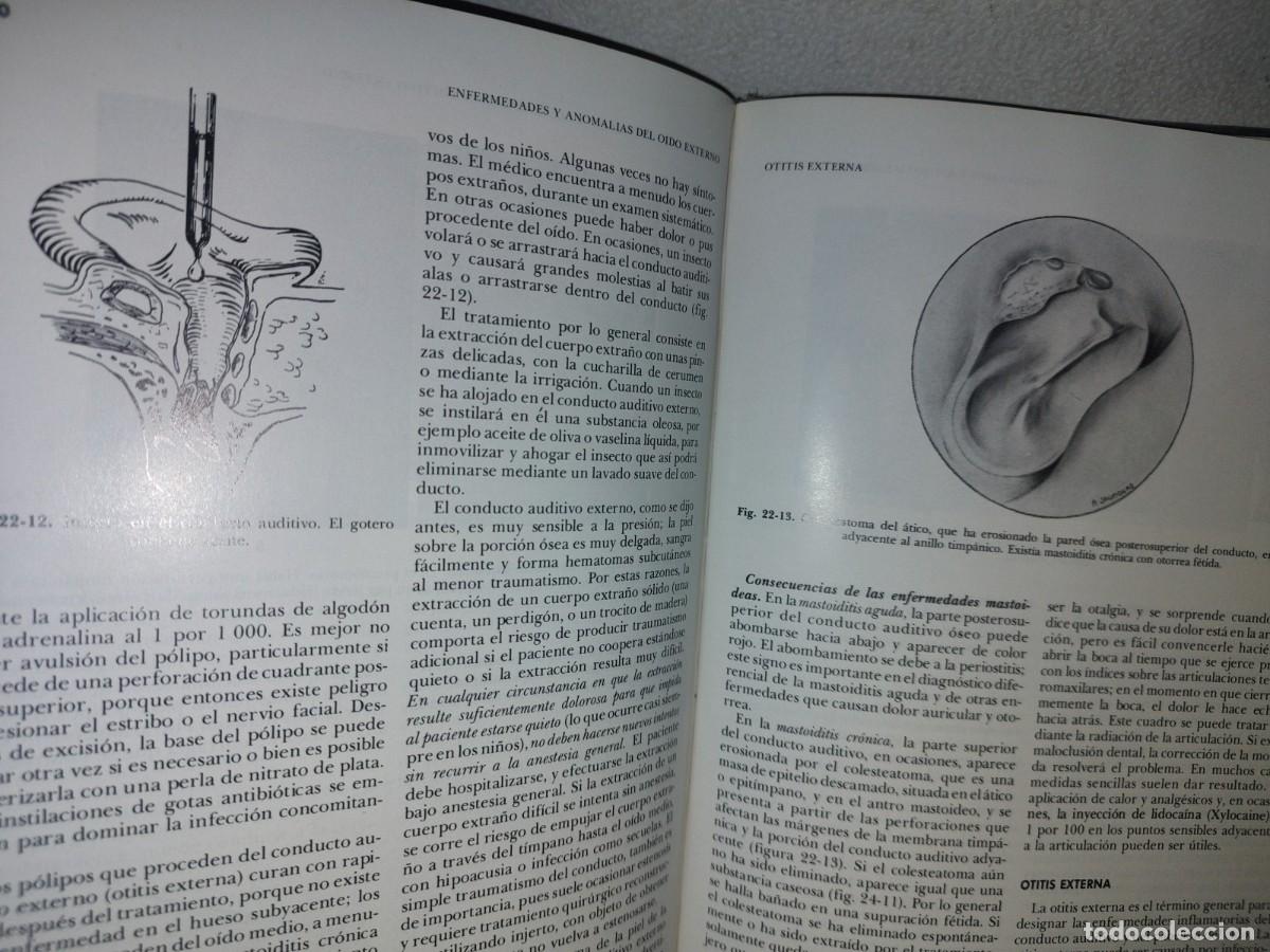 Libros de segunda mano de ciencias: 129- TRATADO DE OTORRINOLARINGOLOG&Iacute;A - DR. DAVID D. DEWEESE - Foto 11