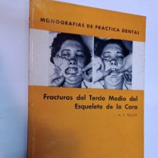 Libros de segunda mano: H.C. KILLEY FRACTURAS DEL TERCIO MEDIO DEL ESQUELETO DE LA CARA SA7484. Lote 313131588