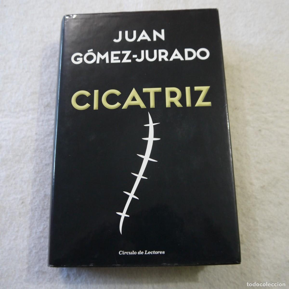 Cicatriz Juan Gómez-jurado
