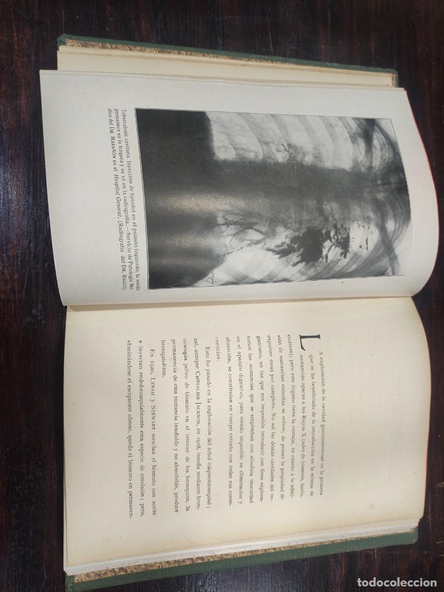 Libros de segunda mano: Libro El lavado pulmonar - Foto 8