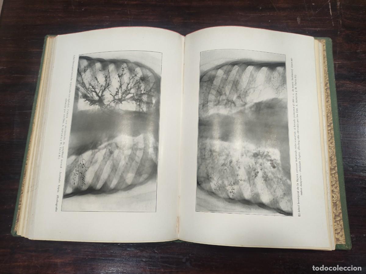 Libros de segunda mano: Libro El lavado pulmonar - Foto 9