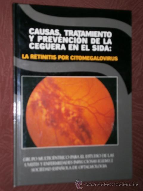 Libros de segunda mano: Causas, tratamiento y prevenci&oacute;n de la ceguera en el SIDA: la retinitis por citomegalovirus