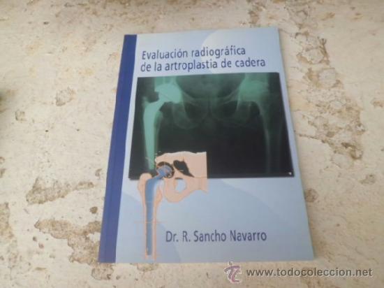 Libri di seconda mano: Libro evaluacion radiografica de la artroplastia de cadera Dr. R. Sancho. L-3852