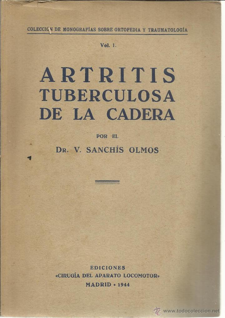 Libri di seconda mano: ARTRITIS TUBERCULOSA DE LA CADERA. V. SANCH&Iacute;S OLMOS. EDI. CIRUG&Iacute;A DEL APARATO LOCOMOTOR. MADRID.1944
