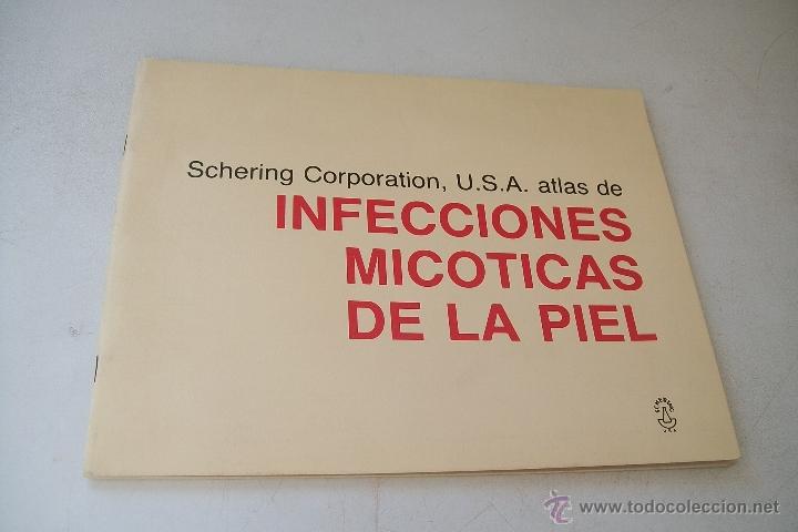Second hand books: INFECCIONES MICOTICAS DE LA PIEL-SCHERING CORPORATION, U.S.A. ATLAS -1977