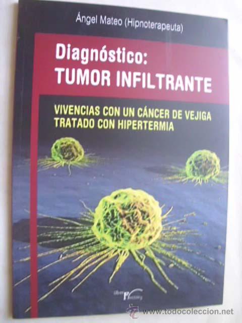 Libri di seconda mano: DIAGN&Oacute;STICO: TUMOR INFILTRANTE. MATEO, &Aacute;ngel. 2012