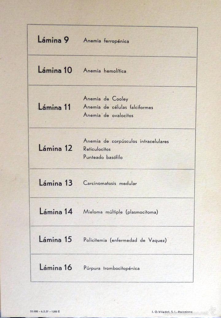 Libros de segunda mano: LAMINAS HEMATOLOGICAS. LABORATORIOS ROCHE. 15 LAMINAS. - Foto 4