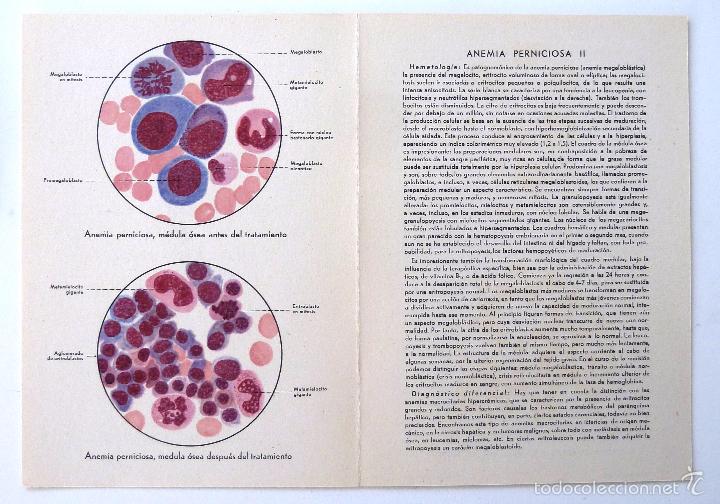 Libros de segunda mano: LAMINAS HEMATOLOGICAS. LABORATORIOS ROCHE. 15 LAMINAS. - Foto 8