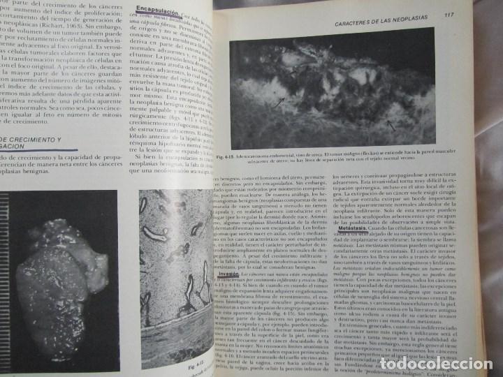 Libros de segunda mano: Patolog&iacute;a estructural y funcional Robbins 1975 - Foto 9