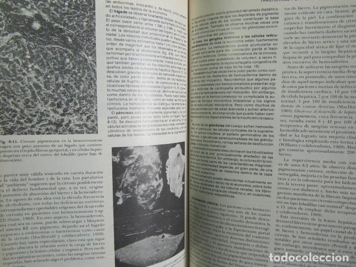 Libros de segunda mano: Patolog&iacute;a estructural y funcional Robbins 1975 - Foto 10