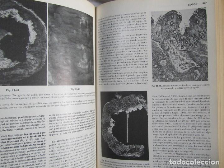 Libros de segunda mano: Patolog&iacute;a estructural y funcional Robbins 1975 - Foto 11