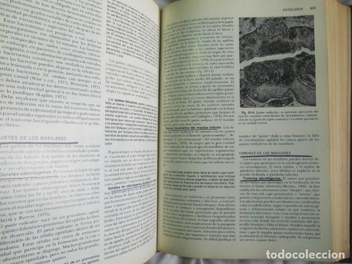 Libros de segunda mano: Patolog&iacute;a estructural y funcional Robbins 1975 - Foto 12