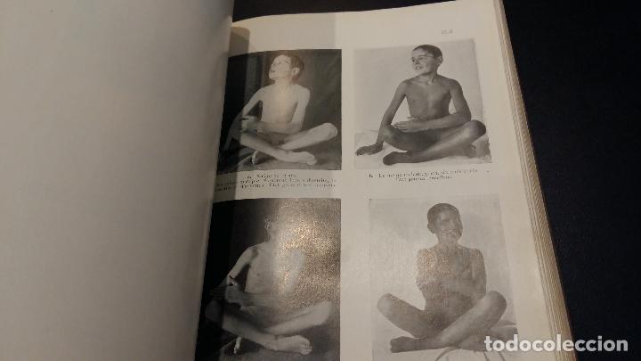 Libros de segunda mano: La cure de soleil / A. Rollier / 1915 - Foto 5