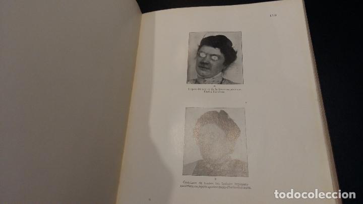 Libros de segunda mano: La cure de soleil / A. Rollier / 1915 - Foto 6