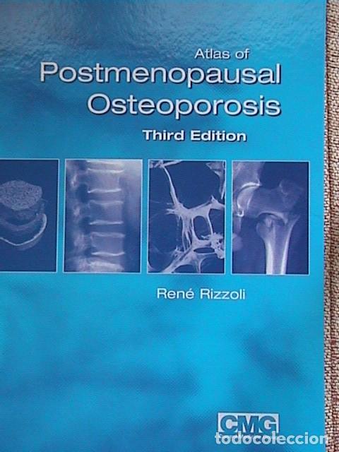 Libros de segunda mano: atlas postmenopausal osteoporosis - Foto 1