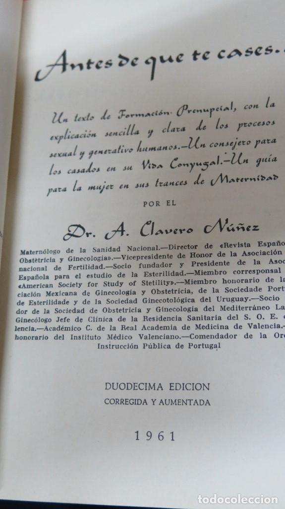 Libros de segunda mano: ANTES DE QUE TE CASES. DR. CLAVERO NU&Ntilde;EZ - Foto 4