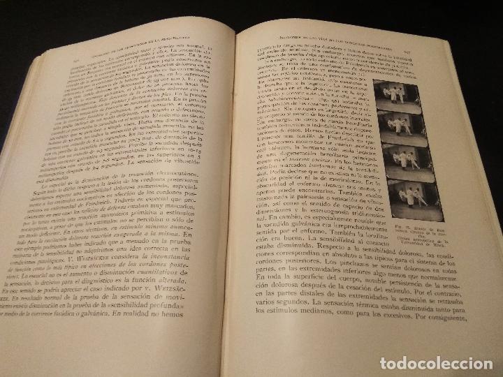 Libros de segunda mano: LOS SINDROMES NEUROPATOL&Oacute;GICOS. PROF. M. KROLL - Foto 2