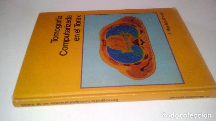 Libros de segunda mano: TOMOGRAFIA COMPUTARIZADA EN EL TORAX- A. manchon grimalt-1982 - Foto 1
