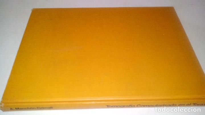 Libros de segunda mano: TOMOGRAFIA COMPUTARIZADA EN EL TORAX- A. manchon grimalt-1982 - Foto 2