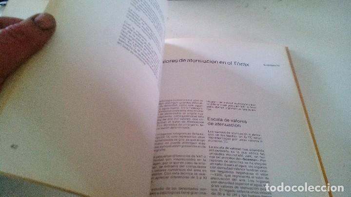 Libros de segunda mano: TOMOGRAFIA COMPUTARIZADA EN EL TORAX- A. manchon grimalt-1982 - Foto 11