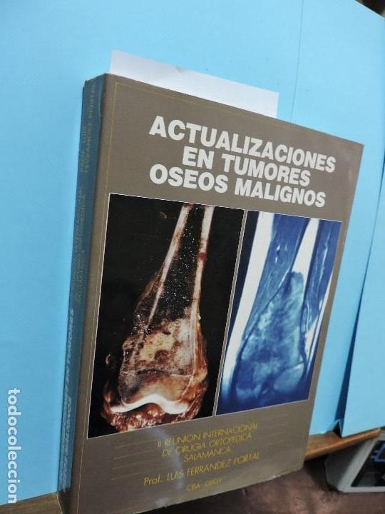 Gebrauchte B&uuml;cher: Actualizaciones en tumores &oacute;seos malignos. II Reuni&oacute;n Internacional de Cirug&iacute;a Ortop&eacute;dica