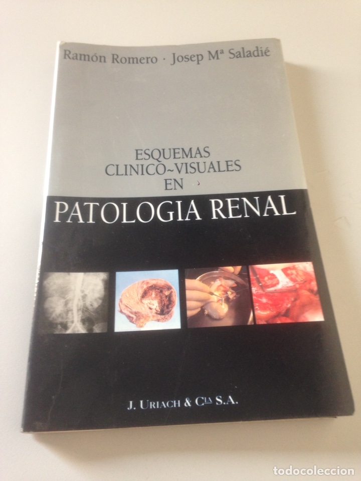 Libros de segunda mano: PATOLOG&Iacute;A RENAL - Foto 1