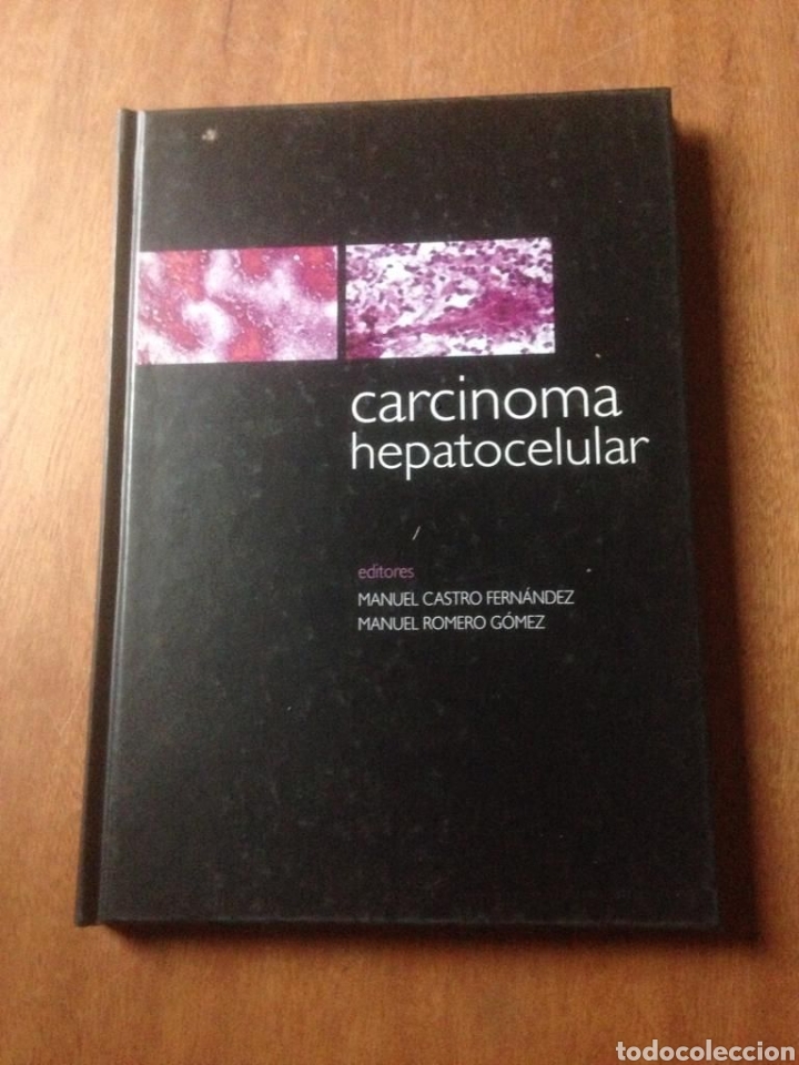 Libros de segunda mano: carcinoma hepatocelular - Foto 1