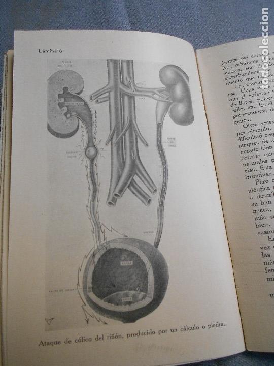 Libros de segunda mano: ARTRITISMO. SU CURACION. - Foto 7