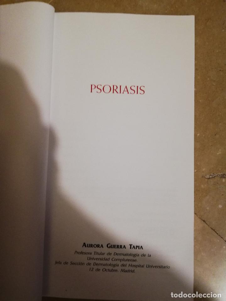 Libros de segunda mano: MANEJO DE LA PSORIASIS (AURORA GUERRA) - Foto 2