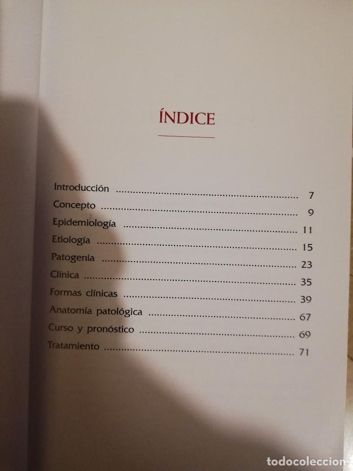 Libros de segunda mano: MANEJO DE LA PSORIASIS (AURORA GUERRA) - Foto 3