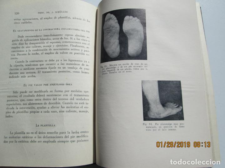 Libros de segunda mano: ORTOPEDIA - J. SCHULLER - 1942 LABORATORIOS ROBERT. - Foto 2