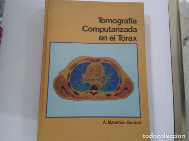 Libros de segunda mano: TOMOGRAF&Iacute;A COMPUTERIZADA EN EL TORAX / MANCHON GRIMALT - Foto 1