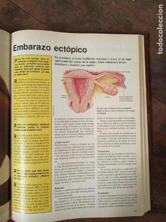 Libros de segunda mano: El m&eacute;dico responde. Abc. 3 tomos. - Foto 7
